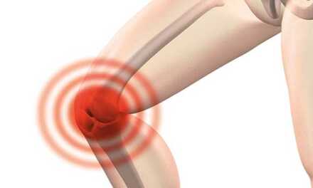 10 Conseils et Astuces pour Soulager la Douleur aux Genoux