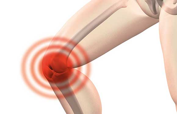 10 Conseils et Astuces pour Soulager la Douleur aux Genoux