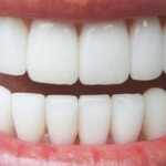 12 Astuces pour Avoir des Dents Blanches et un Sourire Éclatant
