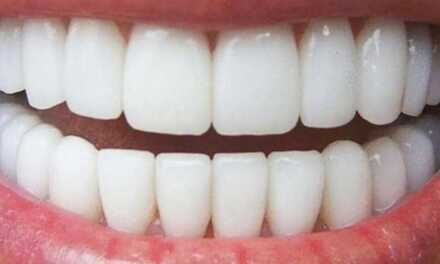 12 Astuces pour Avoir des Dents Blanches et un Sourire Éclatant
