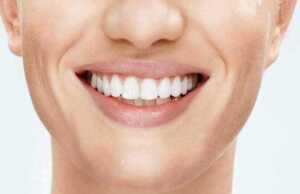 La Couleur des Dents
