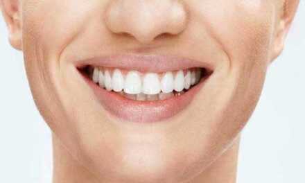 Déformations Dentaires et Traitement par Orthodontie & Orthopédie