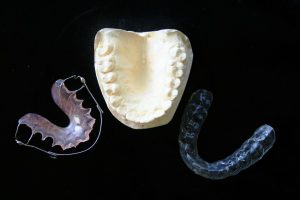 Gouttières Dentaires Orthodontiques