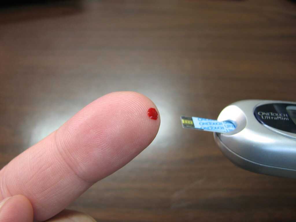 Keto Diet and Diabetes