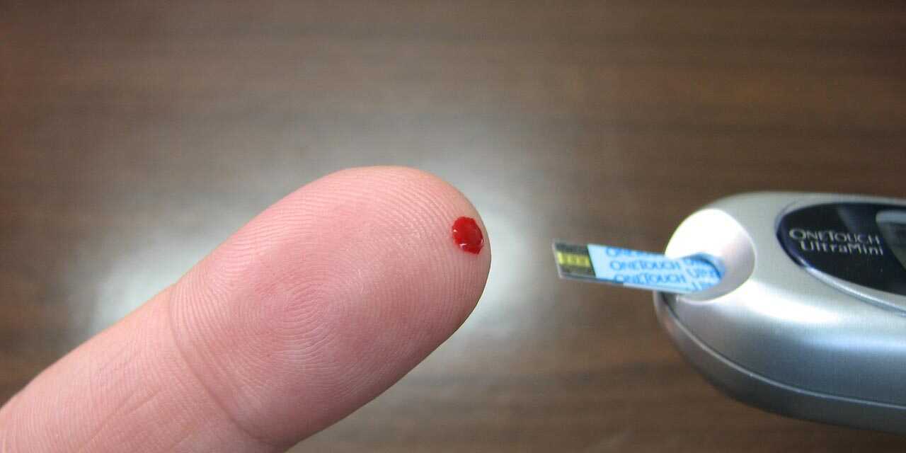 Diabetes Guide: Causes, Symptoms, Treatment, and Prevention