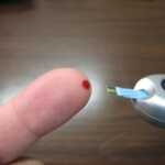 Diabetes Guide: Causes, Symptoms, Treatment, and Prevention