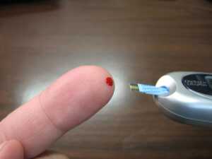 Arthrosis Prevention: Controlling your Blood Sugar