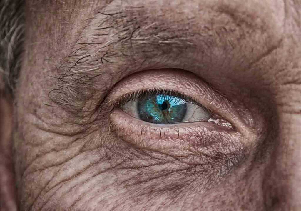 Rides autour des yeux