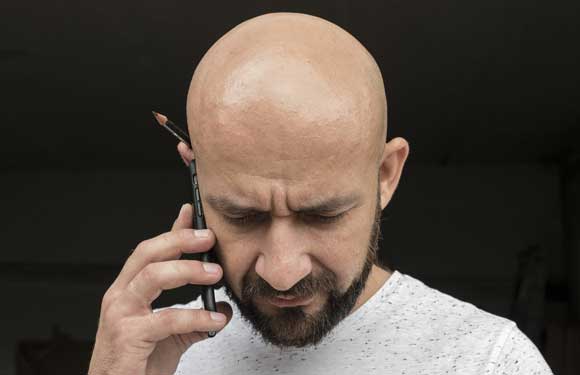 Perte de Cheveux : Causes, Prévention et Traitement de la Chute de Cheveux