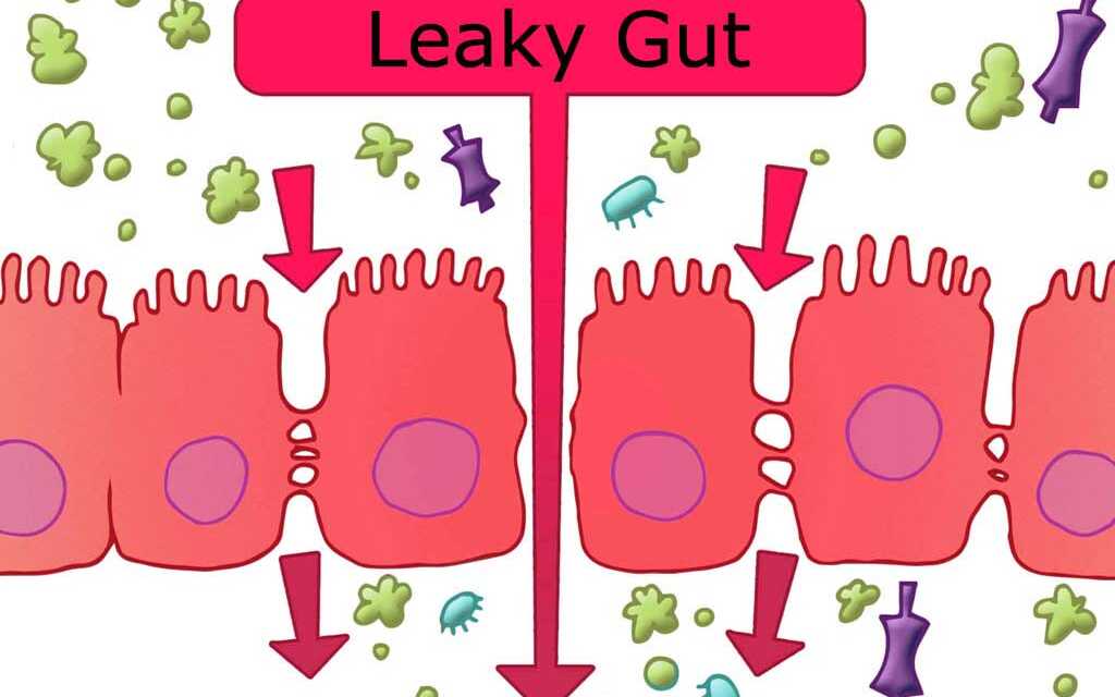 Intestin Perméable : Causes, Symptômes et Traitement de l&rsquo;Intestin Passoire