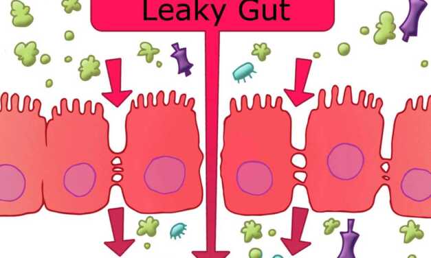 Intestin Perméable : Causes, Symptômes et Traitement de l&rsquo;Intestin Passoire