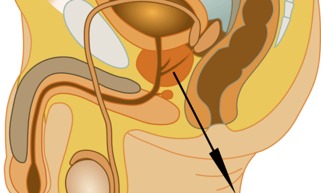 Quels Compléments Alimentaires Acheter pour Votre Prostate ?