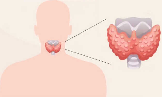 9 Conseils et Remèdes Naturels pour Réguler et Prendre Soin de Votre Thyroïde