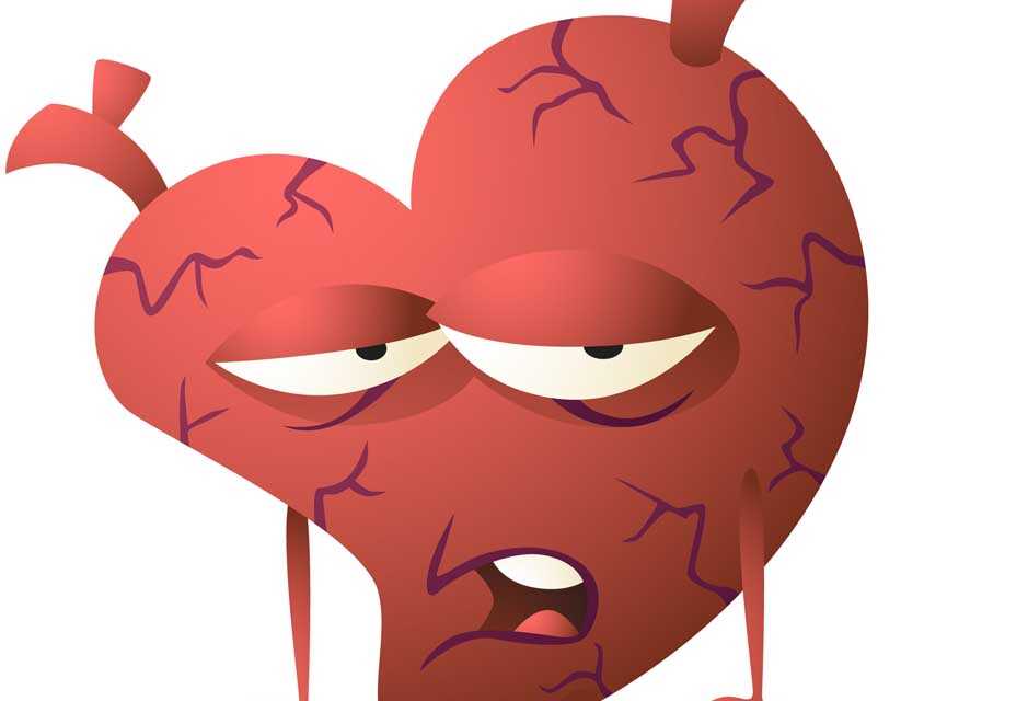 Insuffisance Cardiaque : Causes, Signes, Traitement et Prévention