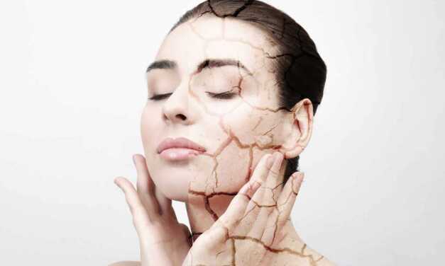 Peau Déshydratée : Causes, Symptômes, Prévention et Traitement
