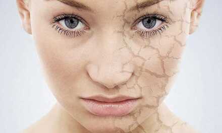 Peau Sèche : Causes, Symptômes, Prévention et Traitement