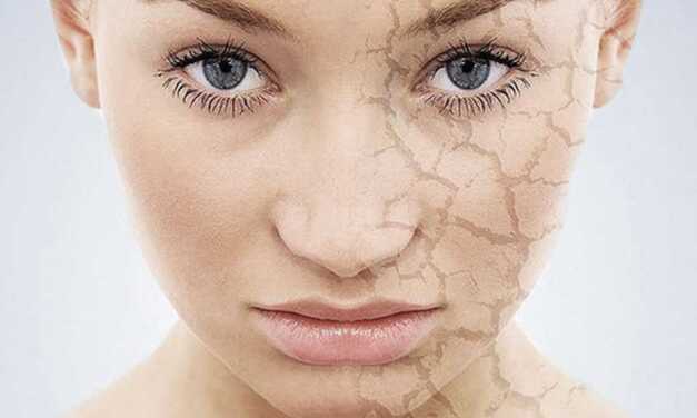 Peau Sèche : Causes, Symptômes, Prévention et Traitement