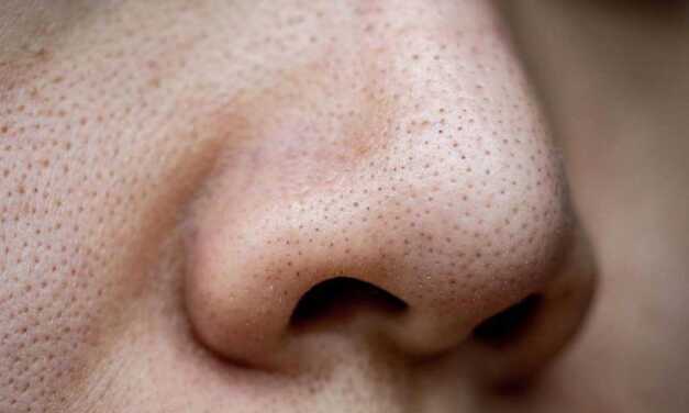 10 Conseils Pratiques pour Enlever les Points Noirs
