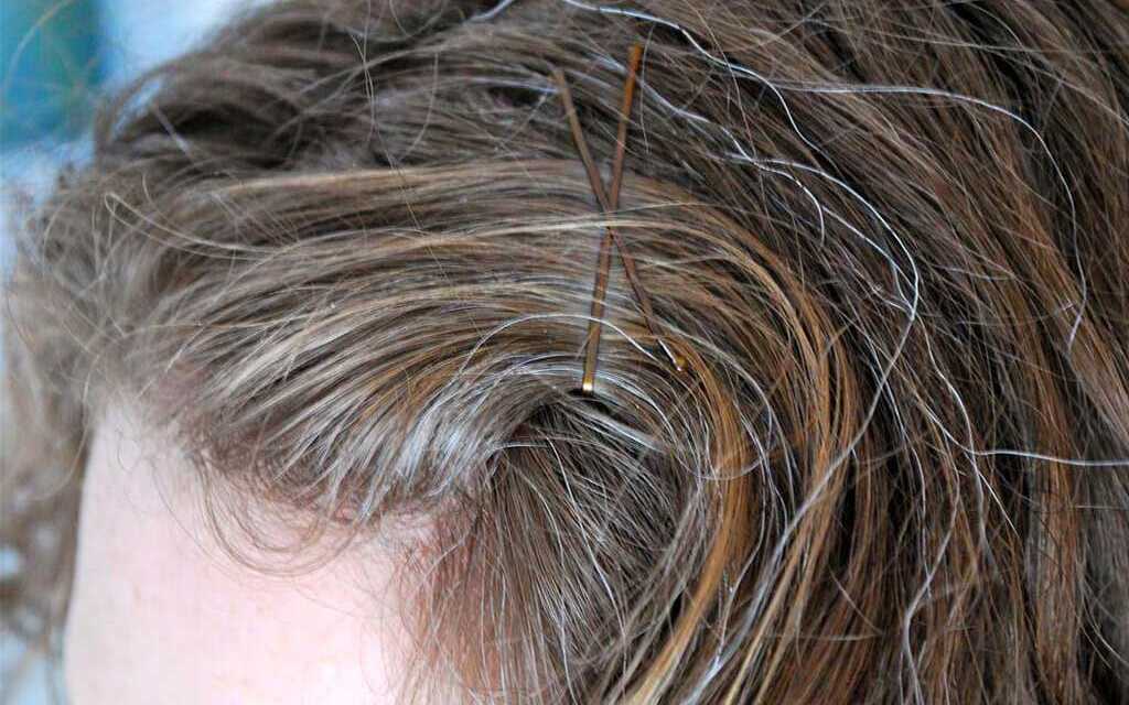 Grisonnement Prématuré : Causes et Prévention des Cheveux Blancs