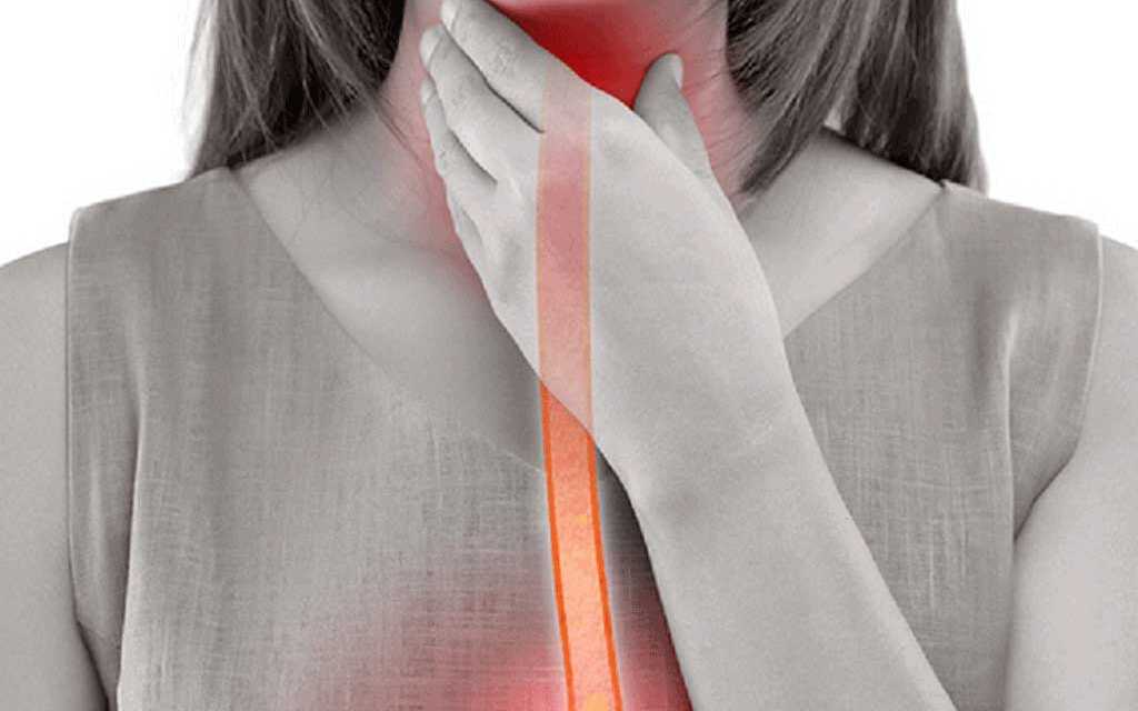 Guide Définitif du Reflux Gastrique